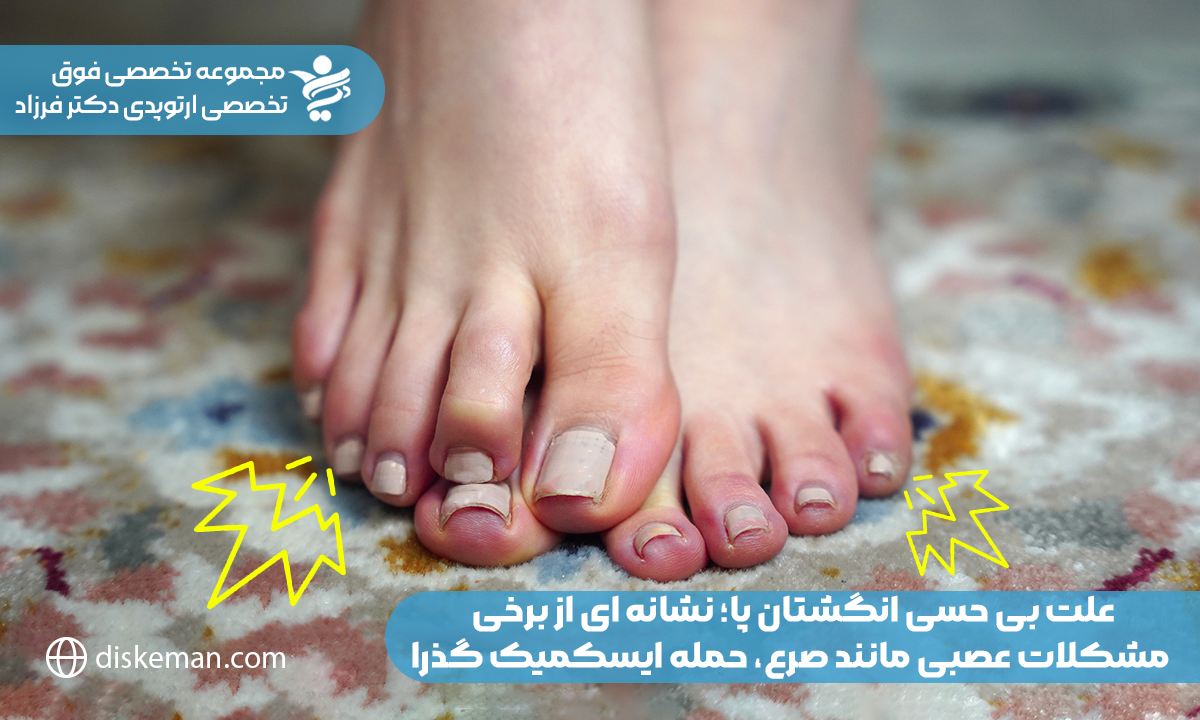 علت بی حسی انگشتان پا؛ نشانهای از برخی مشکلات عصبی مانند صرع، حمله ایسکمیک گذرا